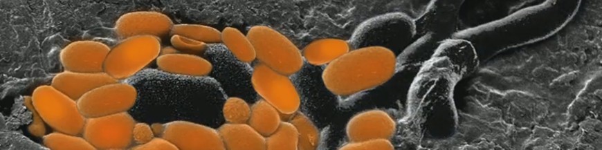 AUREOBASIDIUM PULLULANS